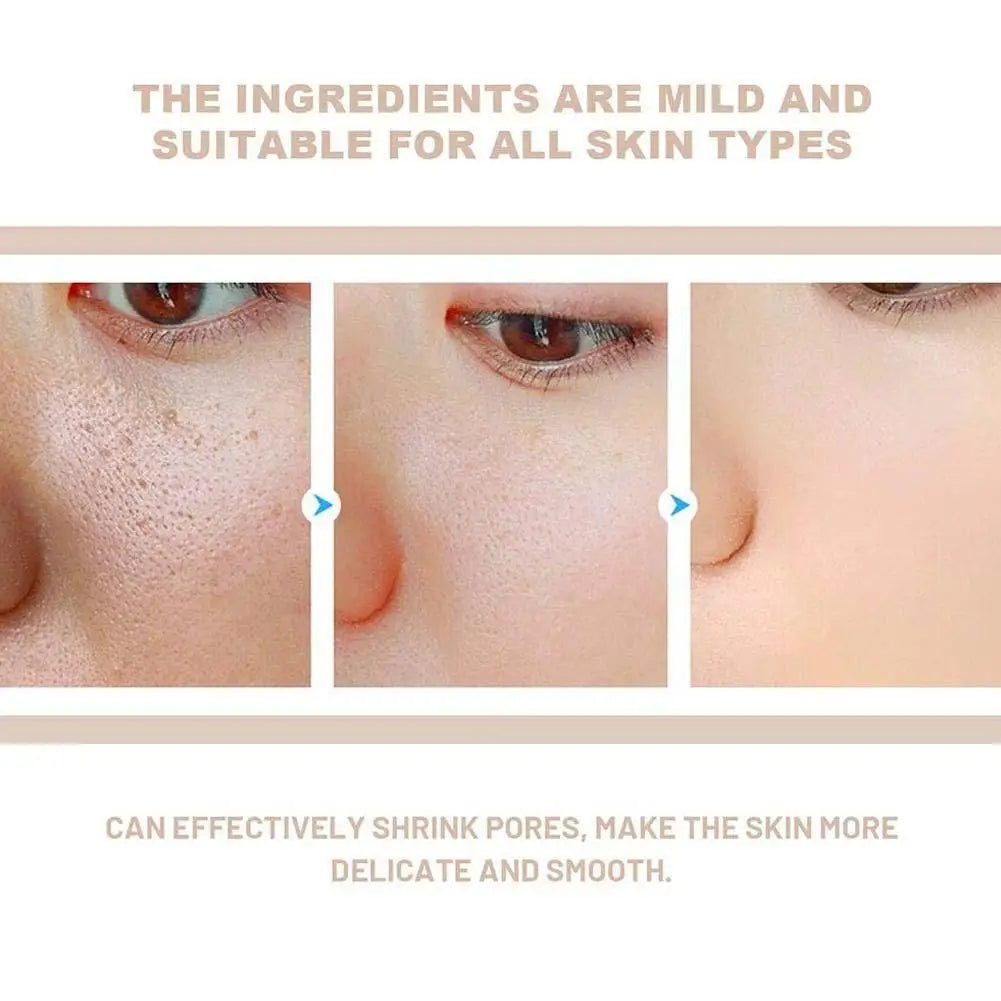 Radiant Balance Exfoliating Essence™