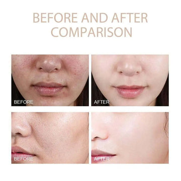 Reveal Your Inner Glow with Flawless Skin!